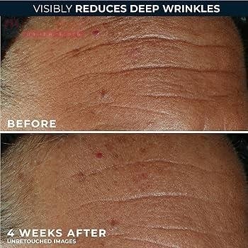 کرم کانتور لیفتینگ و ضدچروک راک آمریکا RoC Derm Correxion Contour